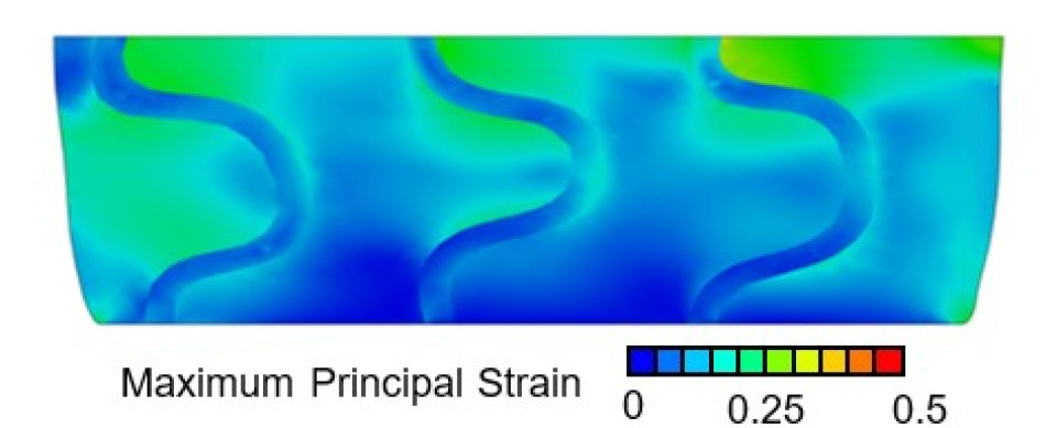 Figure 2: Contour plot of section view of FE model showing maximum principal strain (mm/mm) distribution in a section of the scaffold under the 20% strain loading scenario. Strain is seen to be higher in the fibrin region compared to the stiffer scaffold region.